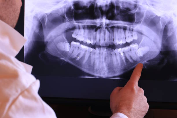 Best Tooth Pain Emergency Relief  in Waxahachie, TX