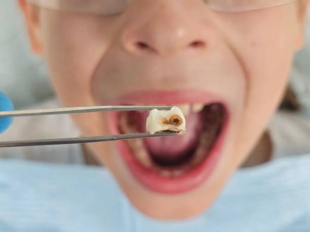 Best Tooth Infection Emergency Dentist  in Waxahachie, TX